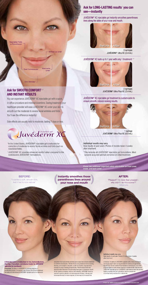 Alpha-Weight-and-Wellness-Orlando-Juvederm-Main