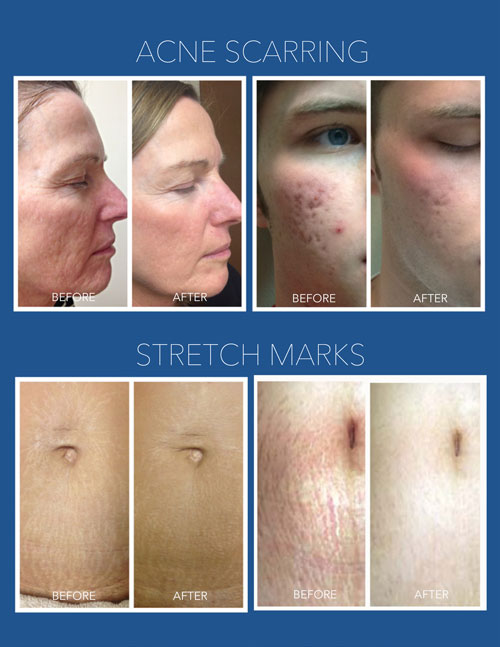 Upstate Dermatology | Medical & Surgical Skin Care